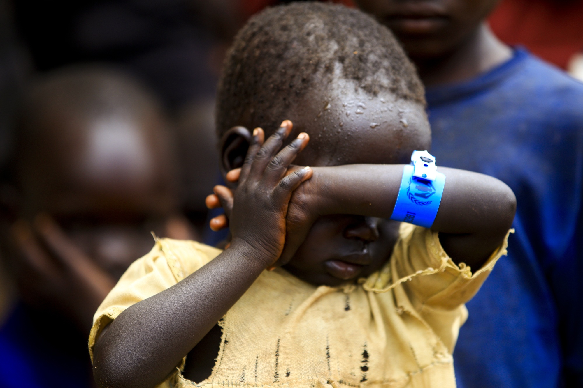 A child from Pajok, South Sudan wearing an arm band signifying his refugee status after his family fled to Uganda to flee the violence.