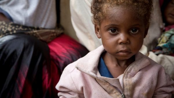 What Causes Child Hunger Malnutrition Around The The World