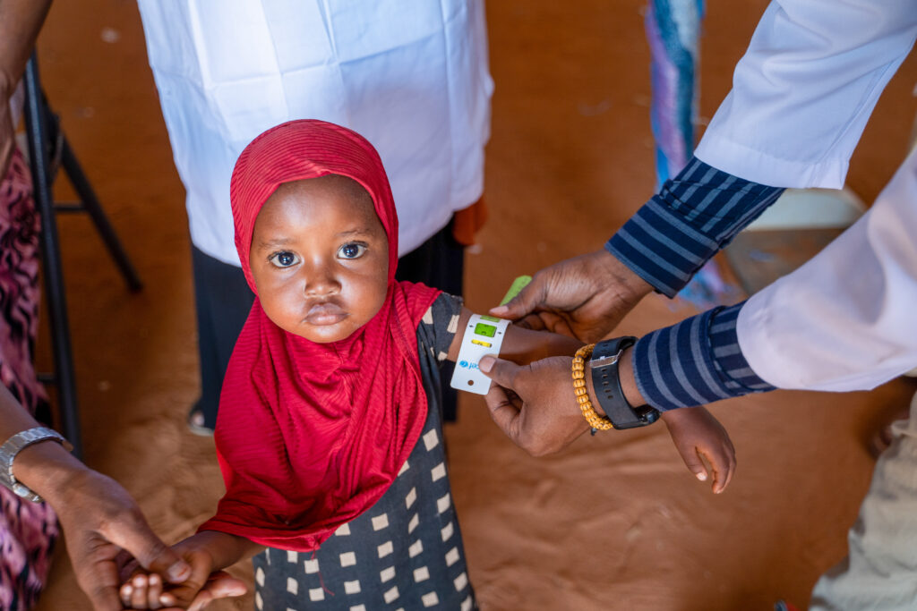 Child at nutrition clinic in Somalia