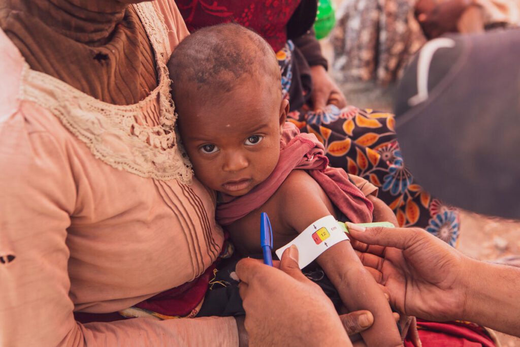 child having his arm measured