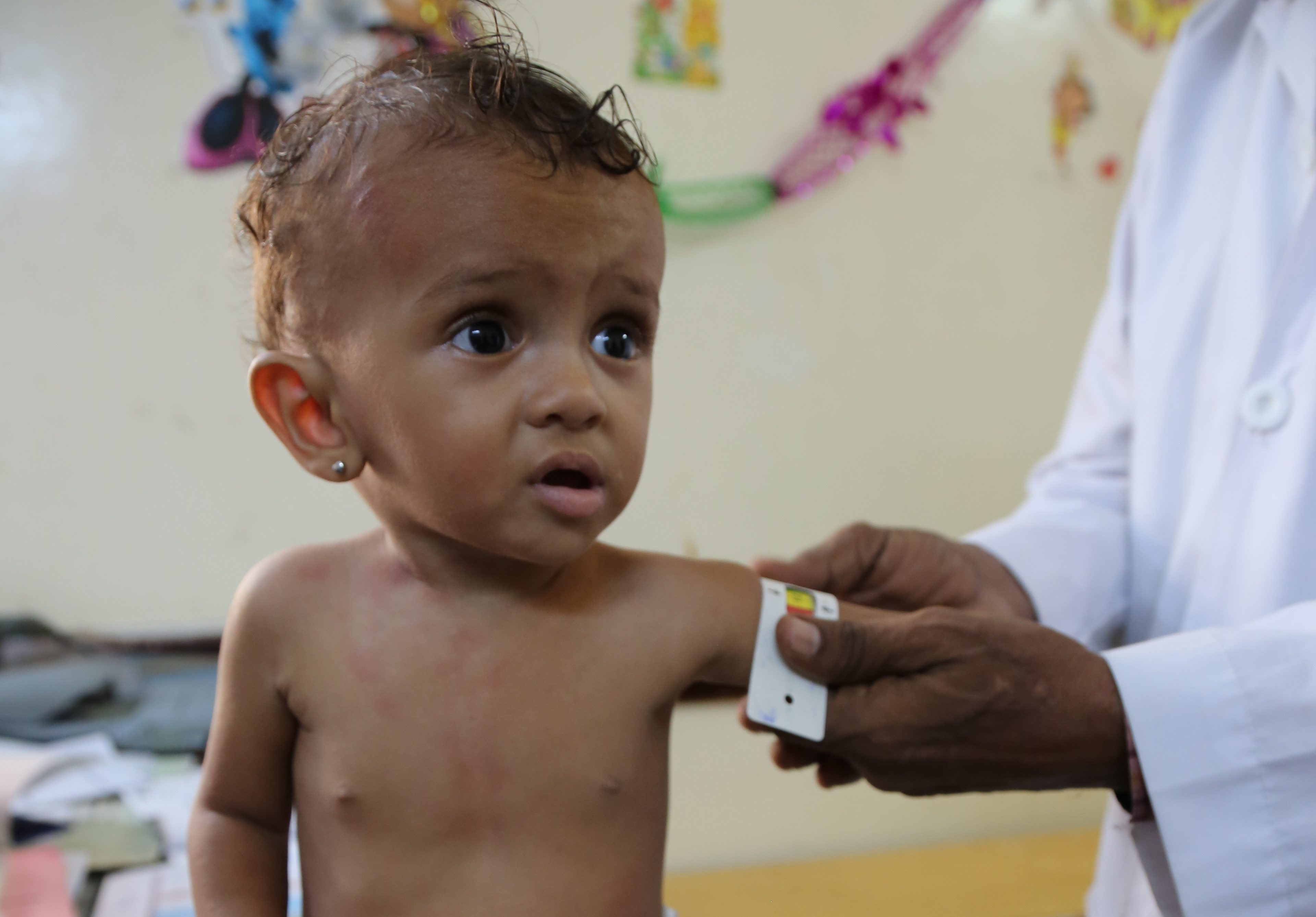 A young child gets her arm measured for nutrition, she looks off to the side with large eyes