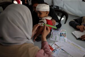 A child in Gaza is evaluated for malnutrition.